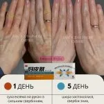 Травяной крем «Чистая кожа» (HAOPIFUCAOBENRUGAO) против псориаза, экземы. Лечение дерматита без гормональных препаратов. Экзема ле