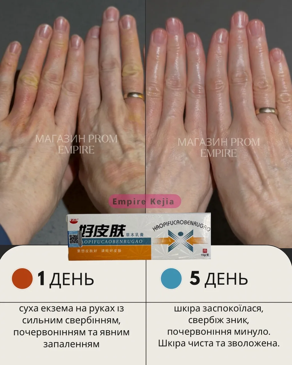 Травяной крем «Чистая кожа» (HAOPIFUCAOBENRUGAO) против псориаза, экземы. Лечение дерматита без гормональных препаратов. Экзема ле — изображение 2